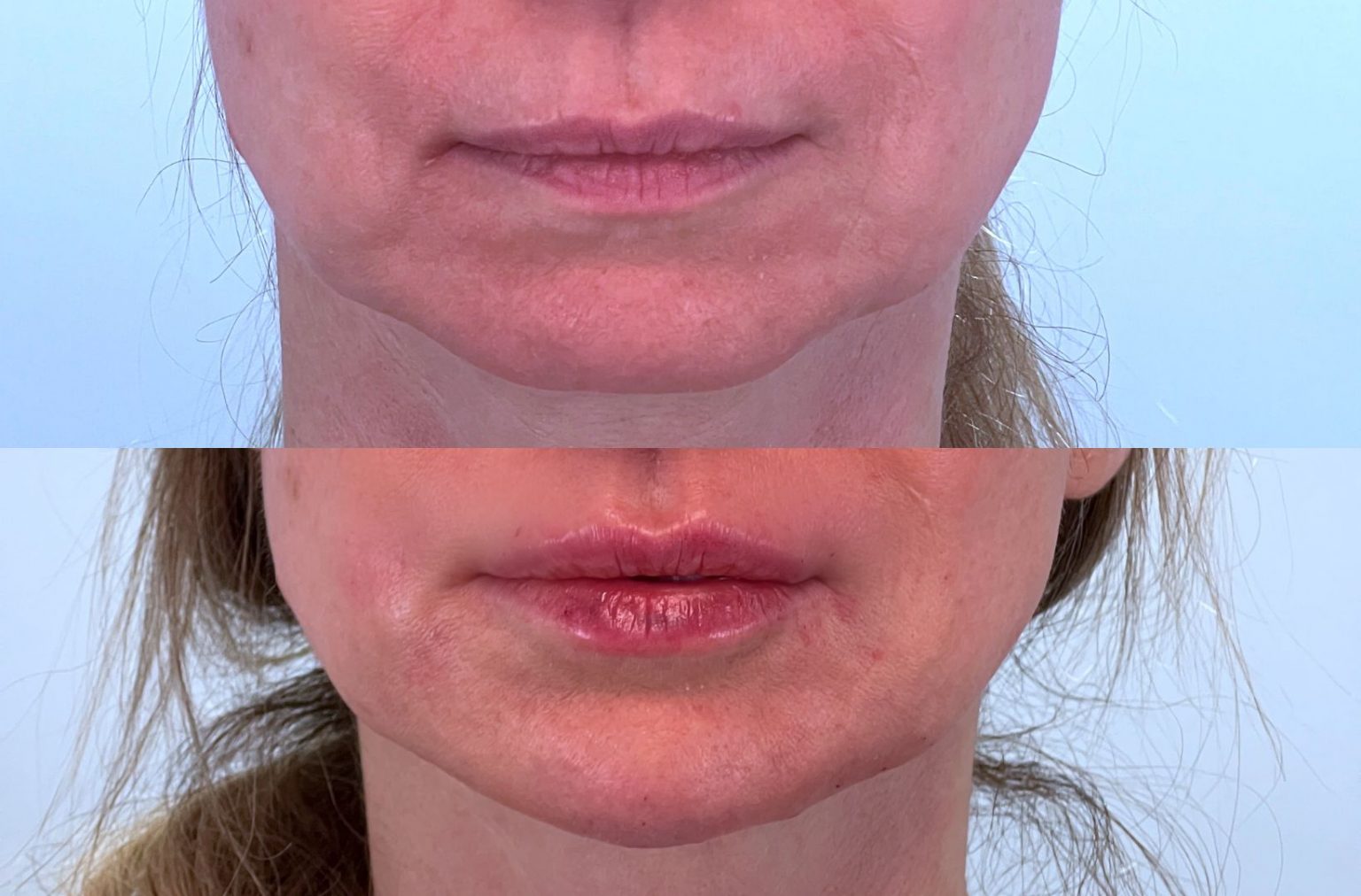 Liquid Beauty Lift