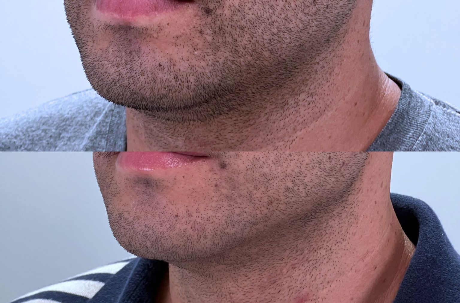 Profile Enhancement