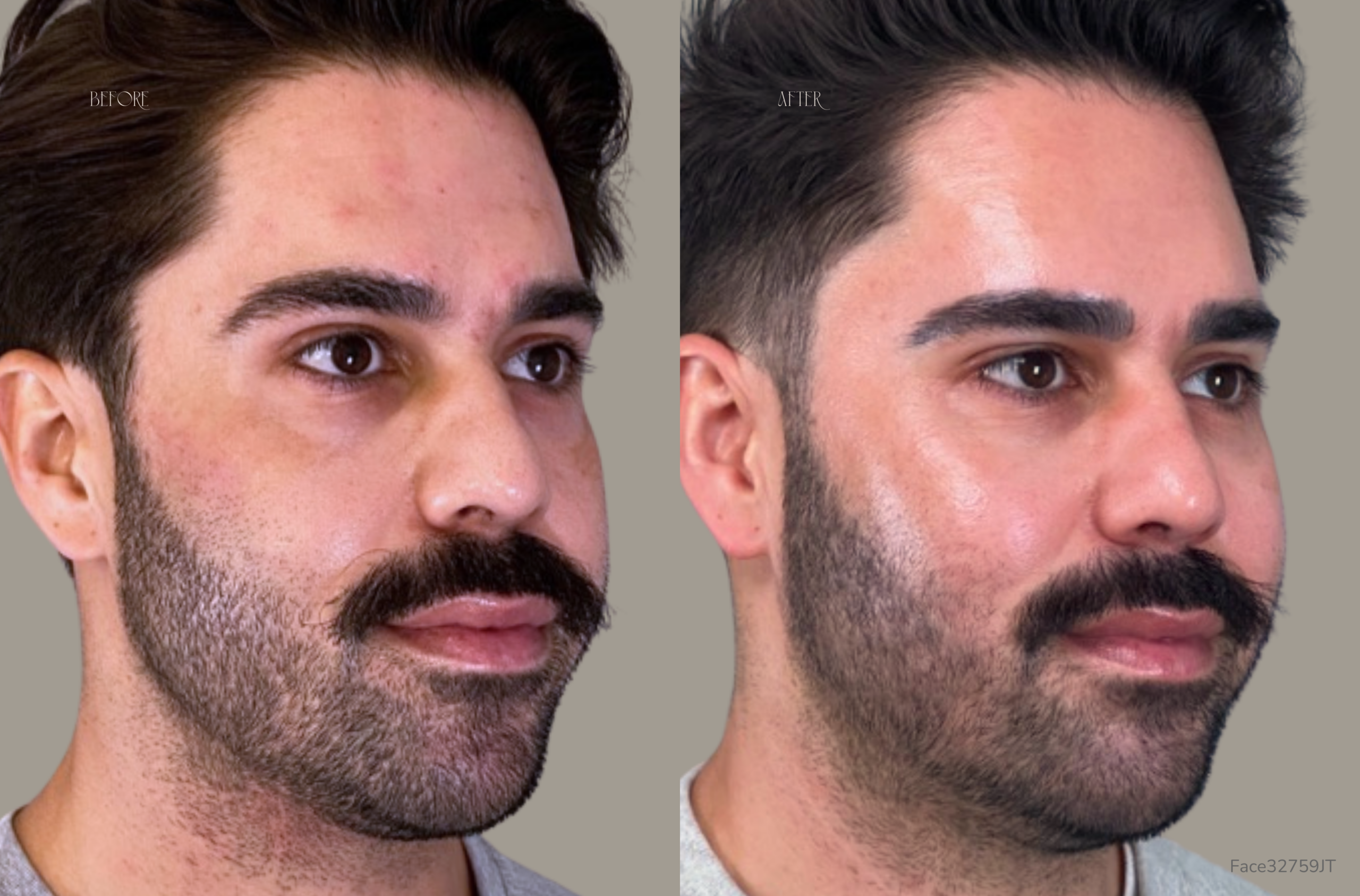 a before and after photo of a male with a mustache and beard